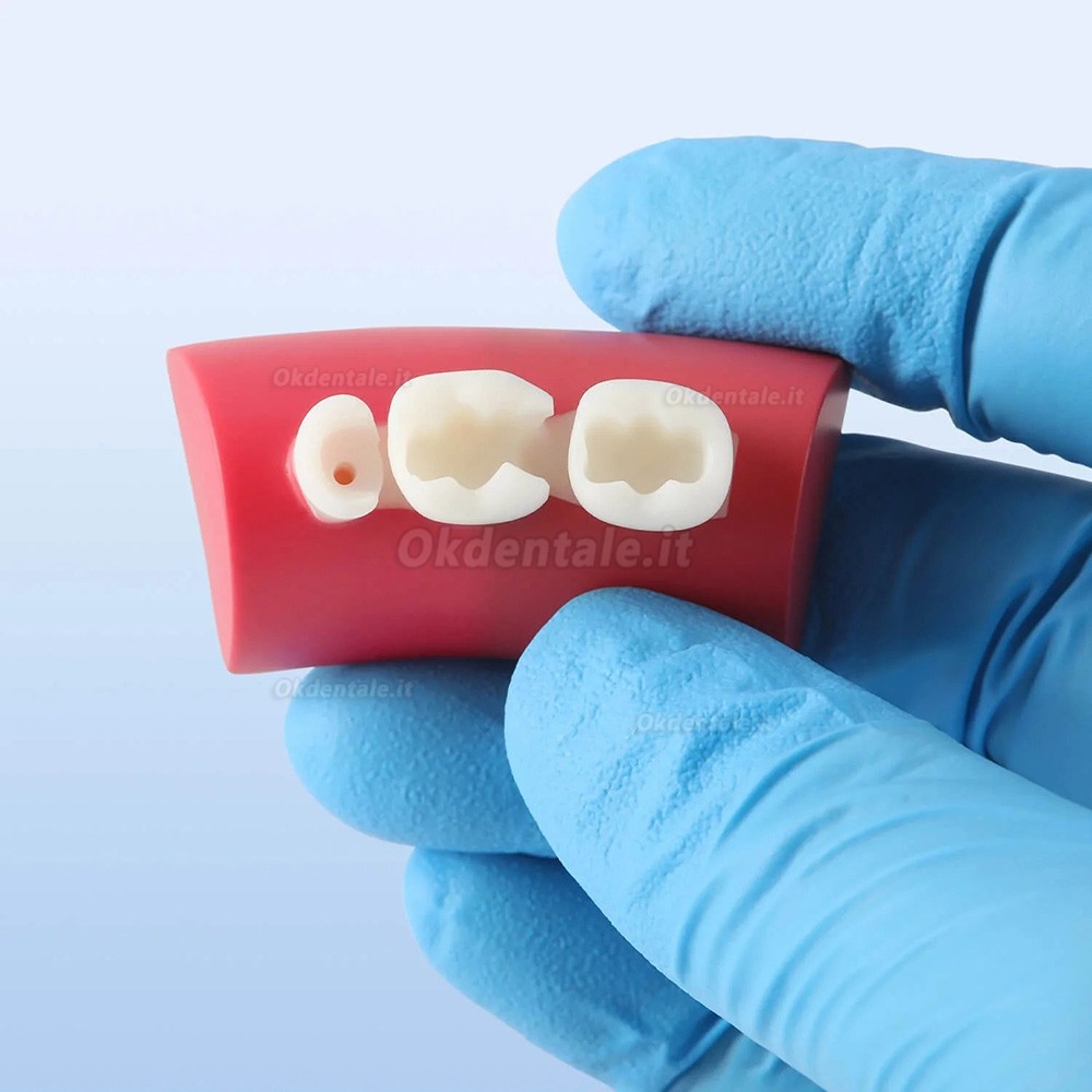 Blocco di esercizi per intarsi dentali, otturazione in resina composita